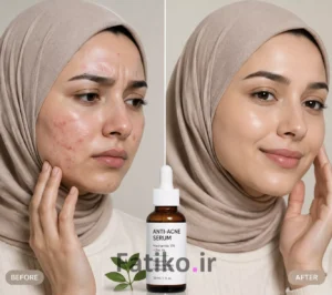 بهترین سرم ضد جوش؛ مقایسه ۵ سرم مؤثر برای پوست چرب و مستعد آکنه